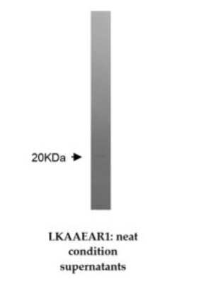 Western Blot: LKAAEAR1 Antibody (Z36P2C1*E7)BSA Free [NBP2-50477]