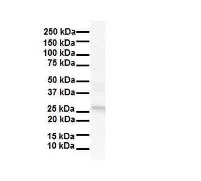 Western Blot: LKAAEAR1 Antibody [NBP1-91428]