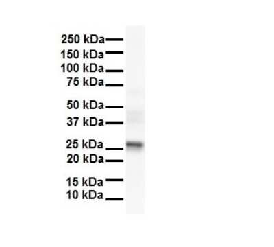 Western Blot: LKAAEAR1 Antibody [NBP1-91428]