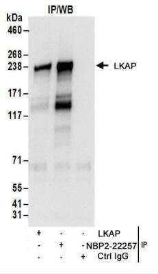 Immunoprecipitation: LKAP Antibody [NBP2-22257]