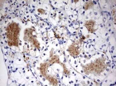 Immunohistochemistry: LKB1/STK11 Antibody (OTI0A3) [NBP2-45460]