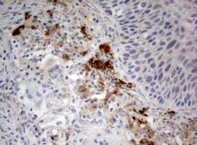 Immunohistochemistry: LKB1/STK11 Antibody (OTI0A3) [NBP2-45460]