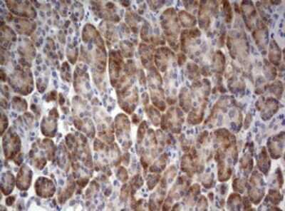 Immunohistochemistry: LKB1/STK11 Antibody (OTI0A3) [NBP2-45460]