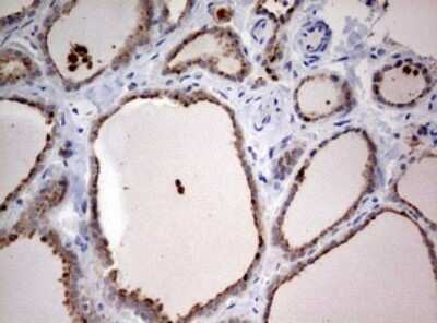 Immunohistochemistry: LKB1/STK11 Antibody (OTI0A3) [NBP2-45460]