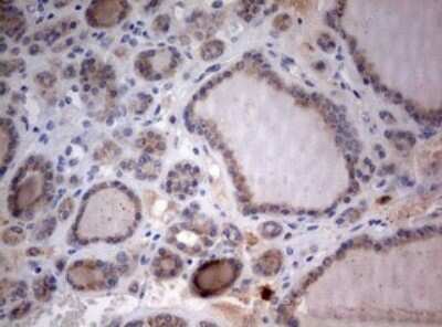 Immunohistochemistry: LKB1/STK11 Antibody (OTI0A3) [NBP2-45460]