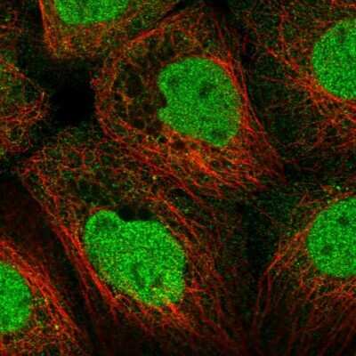 Immunocytochemistry/ Immunofluorescence: LKB1/STK11 Antibody [NBP2-56895]