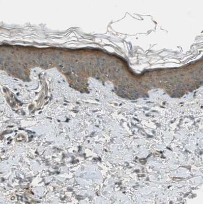 Immunohistochemistry-Paraffin: LKB1/STK11 Antibody [NBP1-87817]