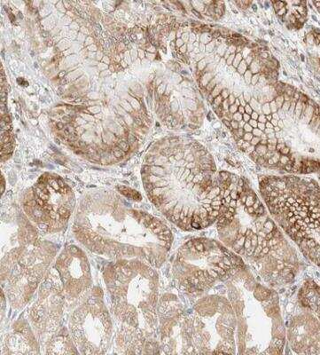 Immunohistochemistry-Paraffin: LLGL2 Antibody [NBP1-81753]