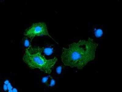 Immunocytochemistry/ Immunofluorescence: LMAN1 Antibody (OTI1A8) [NBP2-03381]
