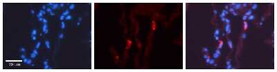 Immunohistochemistry: LMAN2 Antibody [NBP1-69474]