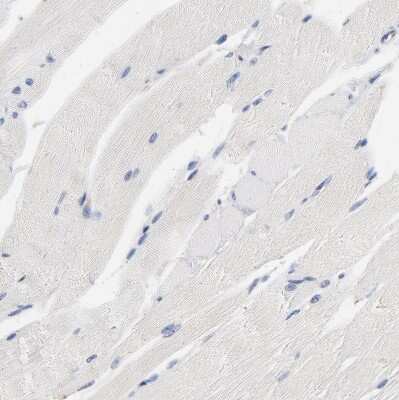 Immunohistochemistry-Paraffin: LMAN2 Antibody [NBP1-86768]