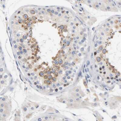 Immunohistochemistry-Paraffin: LMAN2 Antibody [NBP1-86768]