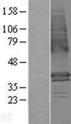 Western Blot: LMBR1 Overexpression Lysate [NBP2-06436]