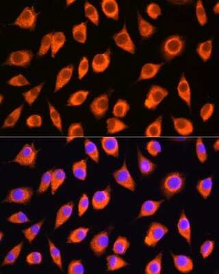 Immunocytochemistry/ Immunofluorescence: LMBRD1 Antibody - Azide and BSA Free [NBP3-04860]