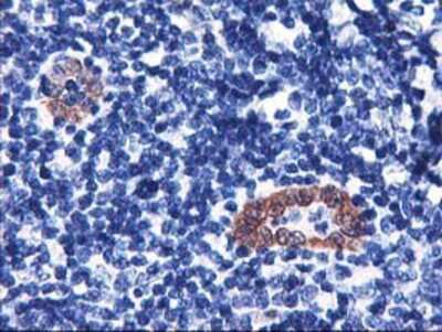 Immunohistochemistry-Paraffin: LMCD1 Antibody (OTI1H5) [NBP2-00934]