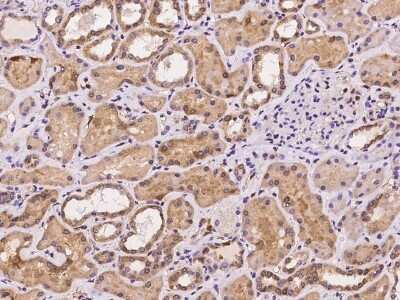 Immunohistochemistry-Paraffin: LMCD1 Antibody [NBP2-97210]