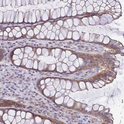 Immunohistochemistry-Paraffin: LMF2 Antibody [NBP2-37996]