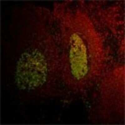 Immunohistochemistry: LMO2 Antibody (1A9-3B11) - BSA Free [NB110-78626]
