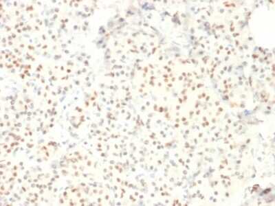 Immunohistochemistry-Paraffin: LMO2 Antibody (LMO2/1971) - Azide and BSA Free [NBP3-08268]