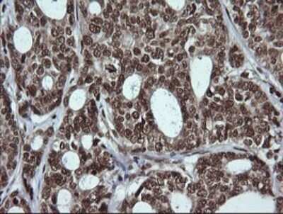 Immunohistochemistry: LMO2 Antibody (OTI1G10) - Azide and BSA Free [NBP2-71157]