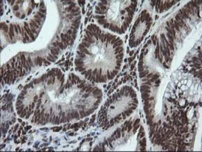 Immunohistochemistry: LMO2 Antibody (OTI1G10) - Azide and BSA Free [NBP2-71157]