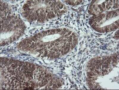 Immunohistochemistry: LMO2 Antibody (OTI1G10) - Azide and BSA Free [NBP2-71157]
