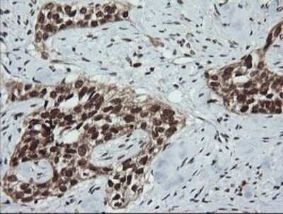 Immunohistochemistry: LMO2 Antibody (OTI1G10) - Azide and BSA Free [NBP2-71157]