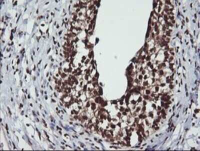 Immunohistochemistry: LMO2 Antibody (OTI1G10) - Azide and BSA Free [NBP2-71157]