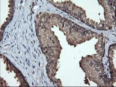 Immunohistochemistry: LMO2 Antibody (OTI1G10) - Azide and BSA Free [NBP2-71157]