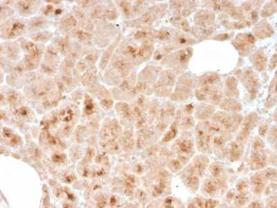 Immunohistochemistry-Paraffin: LMO2 Antibody (rLMO2/1971) [NBP3-07253]