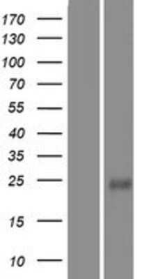 Western Blot: LMO2 Overexpression Lysate [NBP2-10225]