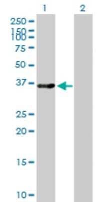 Western Blot: LMOD1 Antibody [H00025802-B01P]