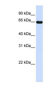 Western Blot: LMOD1 Antibody [NBP1-57623]