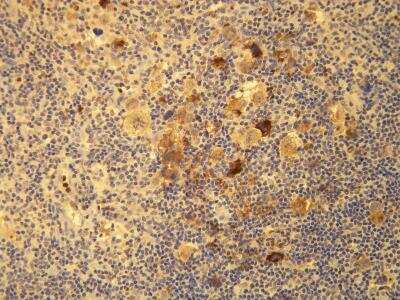 Immunohistochemistry-Paraffin: LMP1 Antibody (D24-G) [NBP1-79008]