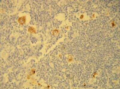 Immunohistochemistry-Paraffin: LMP1 Antibody (S20-D) [NBP1-79009]