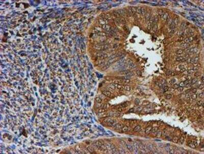 Immunohistochemistry-Paraffin: LMP2/PSMB9 Antibody (OTI1D1) [NBP2-01817]
