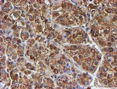 Immunohistochemistry-Paraffin: LMP2/PSMB9 Antibody (OTI1D1) [NBP2-01817]
