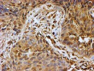 Immunohistochemistry-Paraffin: LMP2/PSMB9 Antibody (OTI1D1) [NBP2-01817]
