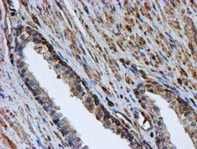 Immunohistochemistry-Paraffin: LMP2/PSMB9 Antibody (OTI1D1) [NBP2-01817]