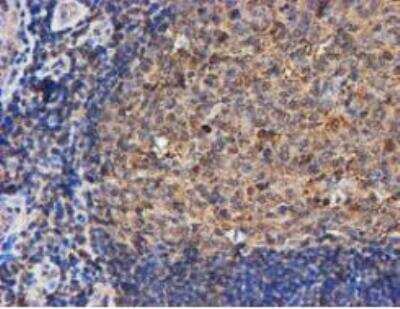 Immunohistochemistry-Paraffin: LMP2/PSMB9 Antibody (OTI1D1) [NBP2-01817]