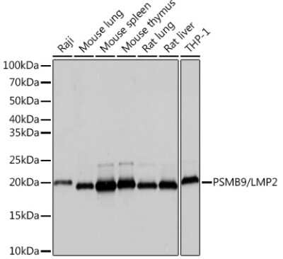 Western Blot: LMP2/PSMB9 Antibody (7Q2G4) [NBP3-16823]