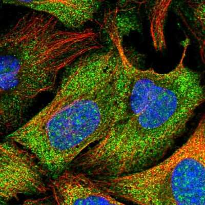 Immunocytochemistry/ Immunofluorescence: LMP2/PSMB9 Antibody [NBP2-55229]