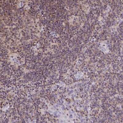 Immunohistochemistry: LMP2/PSMB9 Antibody [NBP2-33681]