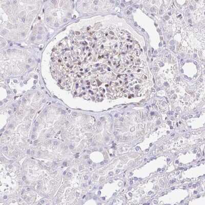 Immunohistochemistry-Paraffin: LMP2/PSMB9 Antibody [NBP2-33681]