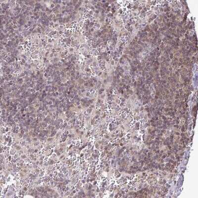 Immunohistochemistry-Paraffin: LMP2/PSMB9 Antibody [NBP2-33681]