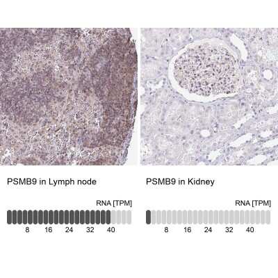 Immunohistochemistry-Paraffin: LMP2/PSMB9 Antibody [NBP2-33681]