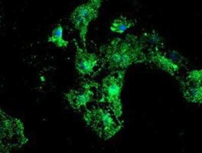 Immunocytochemistry/ Immunofluorescence: LMP2/PSMB9 Antibody (OTI1D1) - Azide and BSA Free [NBP2-71261]