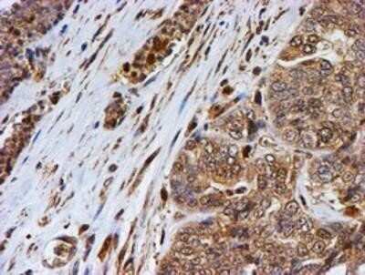 Immunohistochemistry: LMP2/PSMB9 Antibody (OTI1D1) - Azide and BSA Free [NBP2-71261]