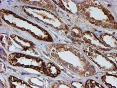 Immunohistochemistry: LMP2/PSMB9 Antibody (OTI1D1) - Azide and BSA Free [NBP2-71261]