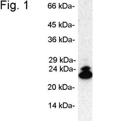Western Blot: LMP2/PSMB9 Antibody [NB300-625]
